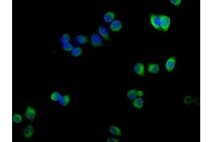 Immunofluorescence staining of PC-3 cells with ABIN7143116 at 1:100,counter-stained with DAPI. (ACTRT1 anticorps  (AA 201-376))