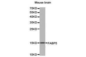 Western Blotting (WB) image for anti-Fatty Acid Binding Protein 5 (Psoriasis-Associated) (FABP5) antibody (ABIN1872637) (FABP5 anticorps)