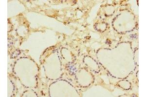 Immunohistochemistry of paraffin-embedded human thyroid tissue using ABIN7161528 at dilution of 1:100