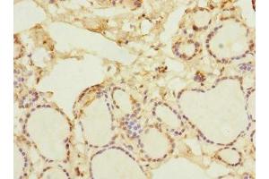 Immunohistochemistry of paraffin-embedded human thyroid tissue using ABIN7161528 at dilution of 1:100 (NFKBIE anticorps  (AA 140-280))
