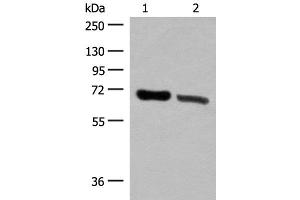 Western blot analysis of Human placenta tissue and Human fetal brain tissue lysates using TRIM8 Polyclonal Antibody at dilution of 1:500 (TRIM8 anticorps)
