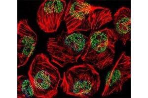 Fluorescent confocal image of U251 cell stained with TBP antibody at 1:25. (TBP anticorps  (AA 210-239))