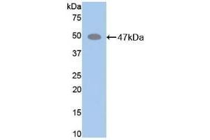Detection of Recombinant ELN, Mouse using Polyclonal Antibody to Elastin (ELN)