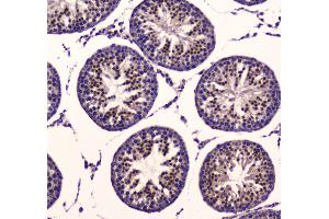 IHC analysis of PDK1 using anti-PDK1 antibody .
