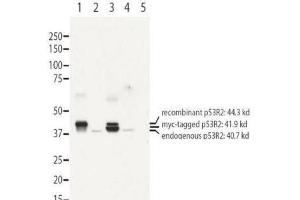 Western blot using  affinity purified anti-RRM2B antibody shows detection of recombinant (lanes 1 and 3) and endogenous protein (lanes 1 to 4) in whole cell extracts from transfected 293T. (RRM2B anticorps  (N-Term))