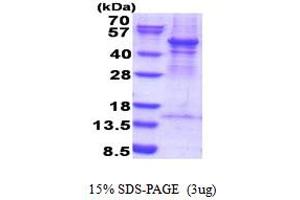 SDS-PAGE (SDS) image for ARP3 Actin-Related Protein 3 (ACTR3) (AA 1-418) protein (His tag) (ABIN5853908)
