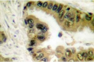 Image no. 1 for anti-Histone Deacetylase 10 (HDAC10) antibody (ABIN265454)