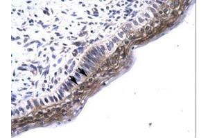 Image no. 1 for anti-TGF-beta Activated Kinase 1/MAP3K7 Binding Protein 2 (TAB2) (N-Term) antibody (ABIN6735781)