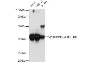 Western blot analysis of extracts of various cell lines, using Cytokeratin 18 (KRT18) Rabbit mAb (ABIN7268097) at 1:1000 dilution. (Cytokeratin 18 anticorps)
