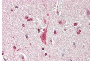 Rabbit Anti-Mxi1 antibody  Formalin Fixed Paraffin Embedded Tissue: Human Brain, Cortex Primary antibody Concentration: 1:200 Secondary Antibody: Donkey anti-Rabbit-Cy3 Secondary Antibody Concentration: 1:200 Magnification: 20x Exposure Time: 0.