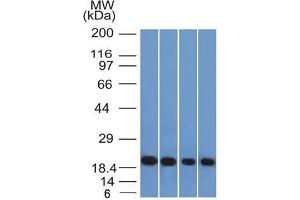 Western Blot of A431, HeLa, Liver and Testis lysate using Ferritin, Light Chain Mouse Monoclonal Antibody (FTL/1386).