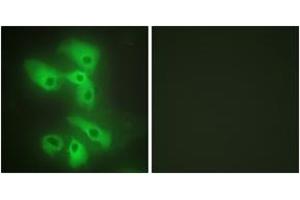 Immunofluorescence analysis of HeLa cells, using JIP2 Antibody. (IB2 anticorps  (AA 581-630))