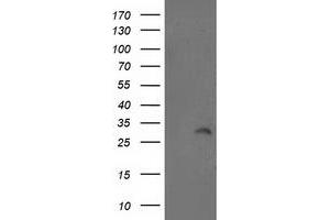 Western Blotting (WB) image for anti-Integral Membrane Protein 2B (ITM2B) antibody (ABIN1496395) (ITM2B anticorps)