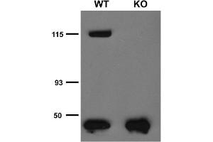 Immunoprecipitation analysis of TRPC5 protein in brain microsomes extracted from wild-type (WT) and TRPC5 knockout (KO) littermates.