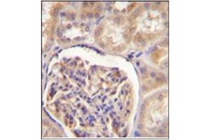 Immunohistochemistry analysis in formalin fixed and paraffin embedded human kidney tissue stained with CYP27B1 Antibody (C-term) Cat. (CYP27B1 anticorps  (C-Term))