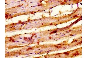 IHC image of ABIN7155352 diluted at 1:500 and staining in paraffin-embedded human skeletal muscle tissue performed on a Leica BondTM system. (MYSM1 anticorps  (AA 170-311))