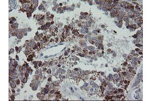 Image no. 3 for anti-Mitochondrial Ribosomal Protein S27 (MRPS27) (AA 151-414) antibody (ABIN1490963)