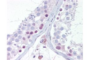 Anti-UTF1 antibody IHC of human testis.