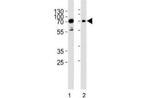 Western blot analysis of lysate from human 1) HeLa, and 2) Jurkat cell line using PAK3 antibody at 1:1000.