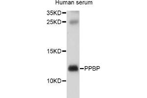 Western blot analysis of extracts of human serum, using PPBP antibody (ABIN5970990) at 1/1000 dilution. (CXCL7 anticorps)