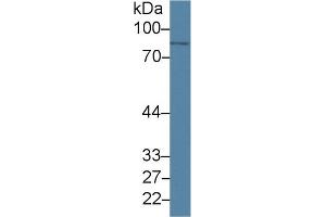 Detection of PLA2G4 in Human Lung lysate using Monoclonal Antibody to Cytosolic Phospholipase A2 (PLA2G4)