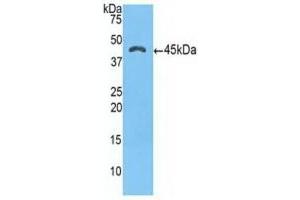 Detection of Recombinant a1ACT, Human using Polyclonal Antibody to Alpha-1-Antichymotrypsin (a1ACT) (SERPINA3 anticorps  (AA 235-394))