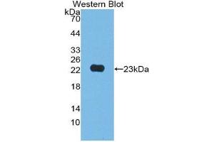 Western Blotting (WB) image for anti-Junctional Adhesion Molecule 2 (JAM2) (AA 74-250) antibody (ABIN1868793) (JAM2 anticorps  (AA 74-250))