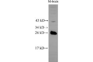 Western Blot analysis of Mouse brain tissue using RAB5B Polyclonal Antibody at dilution of 1:500 (RAB5B anticorps)