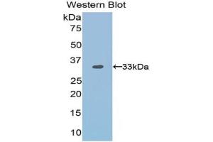 Western blot analysis of the recombinant protein. (OTUB1 anticorps  (AA 1-271))