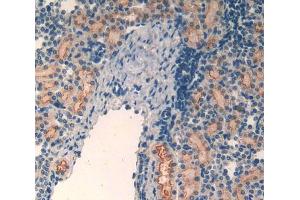 IHC-P analysis of kidney tissue, with DAB staining. (MT2 anticorps  (AA 1-61))