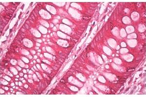 anti-AGR2+AGR3 antibody