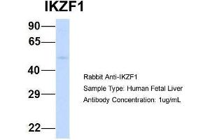 Host:  Rabbit  Target Name:  IKZF1  Sample Type:  Human Fetal Liver  Antibody Dilution:  1. (IKZF1 anticorps  (Middle Region))
