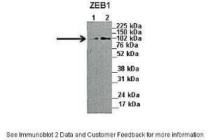 Lanes:   1. (ZEB1 anticorps  (N-Term))