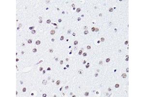 Immunohistochemistry of paraffin-embedded Mouse brain using Acetyl-Histone H2B-K15 Polyclonal Antibody at dilution of 1:100 (40x lens).