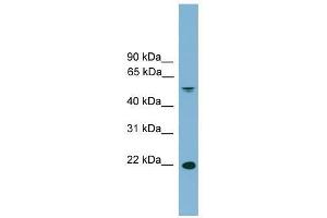 Western Blot showing HDGFRP3 antibody used at a concentration of 1-2 ug/ml to detect its target protein.