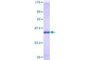 Image no. 1 for RAB Interacting Factor (RABIF) (AA 1-123) protein (GST tag) (ABIN1317242)