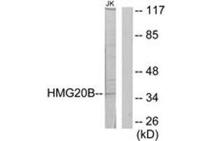 Western blot analysis of extracts from Jurkat cells, using HMG20B Antibody. (HMG20B anticorps  (AA 1-50))
