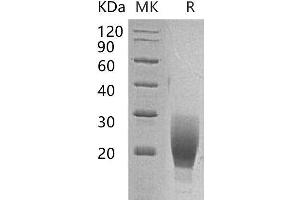 Western Blotting (WB) image for Interleukin 1 Receptor, Type I (IL1R1) protein (Fc Tag) (ABIN7320550)