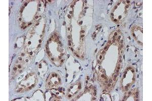 Image no. 3 for anti-ATR Interacting Protein (ATRIP) (AA 42-309) antibody (ABIN1491507)