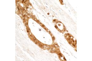 Immunohistochemistry (IHC) image for anti-Stratifin (SFN) (AA 198-248) antibody (ABIN7454767)
