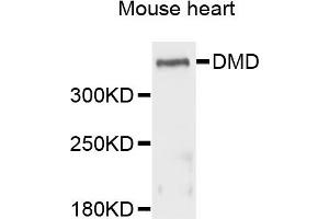 Western blot analysis of extracts of mouse heart cells, using DMD antibody. (Dystrophin anticorps)