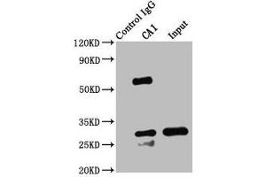 Immunoprecipitating CA1 in K562 whole cell lysate Lane 1: Rabbit control IgG instead of ABIN7146698 in K562 whole cell lysate. (CA1 anticorps  (AA 2-261))