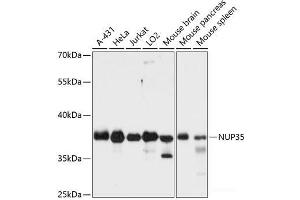 Western blot analysis of extracts of various cell lines using NUP35 Polyclonal Antibody at dilution of 1:3000. (NUP35 anticorps)