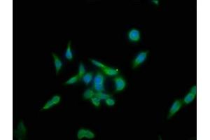 Immunofluorescence staining of PC-3 cells with ABIN7157267 at 1:133, counter-stained with DAPI. (KLHL12 anticorps  (AA 1-220))
