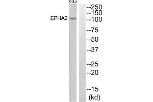 Western blot analysis of extracts from COLO205 and Jurkat cells, using EPHA2 antibody. (EPH Receptor A2 anticorps  (N-Term))