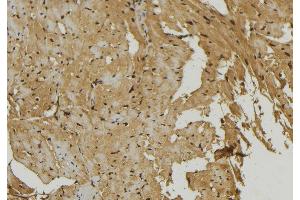 ABIN6273915 at 1/100 staining Mouse muscle tissue by IHC-P.