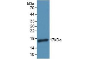 Detection of Recombinant IL4, Human using Polyclonal Antibody to Interleukin 4 (IL4) (IL-4 anticorps  (AA 25-153))