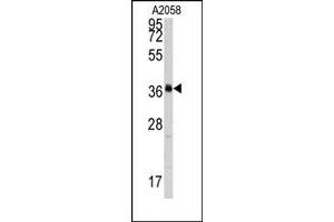 Image no. 1 for anti-Polymerase (RNA) I Polypeptide C, 30kDa (POLR1C) (C-Term) antibody (ABIN358013) (POLR1C anticorps  (C-Term))