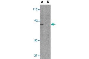 Western blot analysis of AICDA in Ramos whole cell lysate with AICDA polyclonal antibody  at 2 ug/mL in either the (A) absence or (B) presence of blocking peptide. (AICDA anticorps  (C-Term))