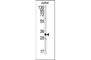 Western blot analysis of anti-CDK2 Antibody (C-term) in Jurkat cell line lysates (35ug/lane). (CDK2 anticorps  (C-Term))